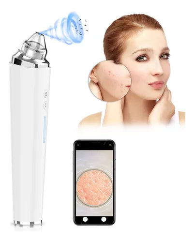 PoreGlow Blackhead Vacuum – Clear Skin in Minutes