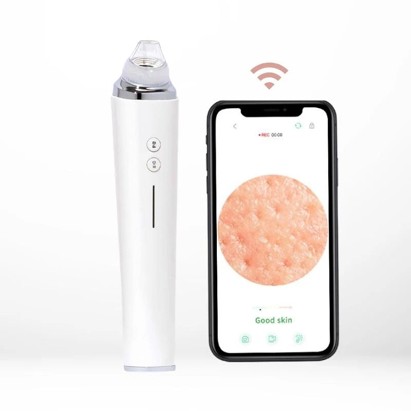PoreGlow Blackhead Vacuum – Clear Skin in Minutes