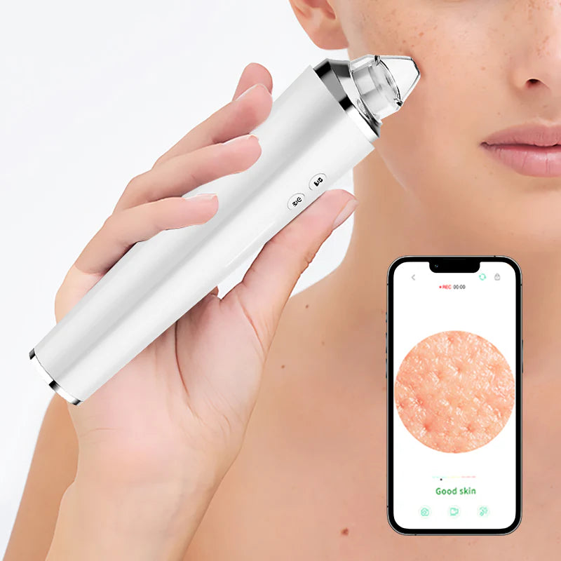 PoreGlow Blackhead Vacuum – Clear Skin in Minutes